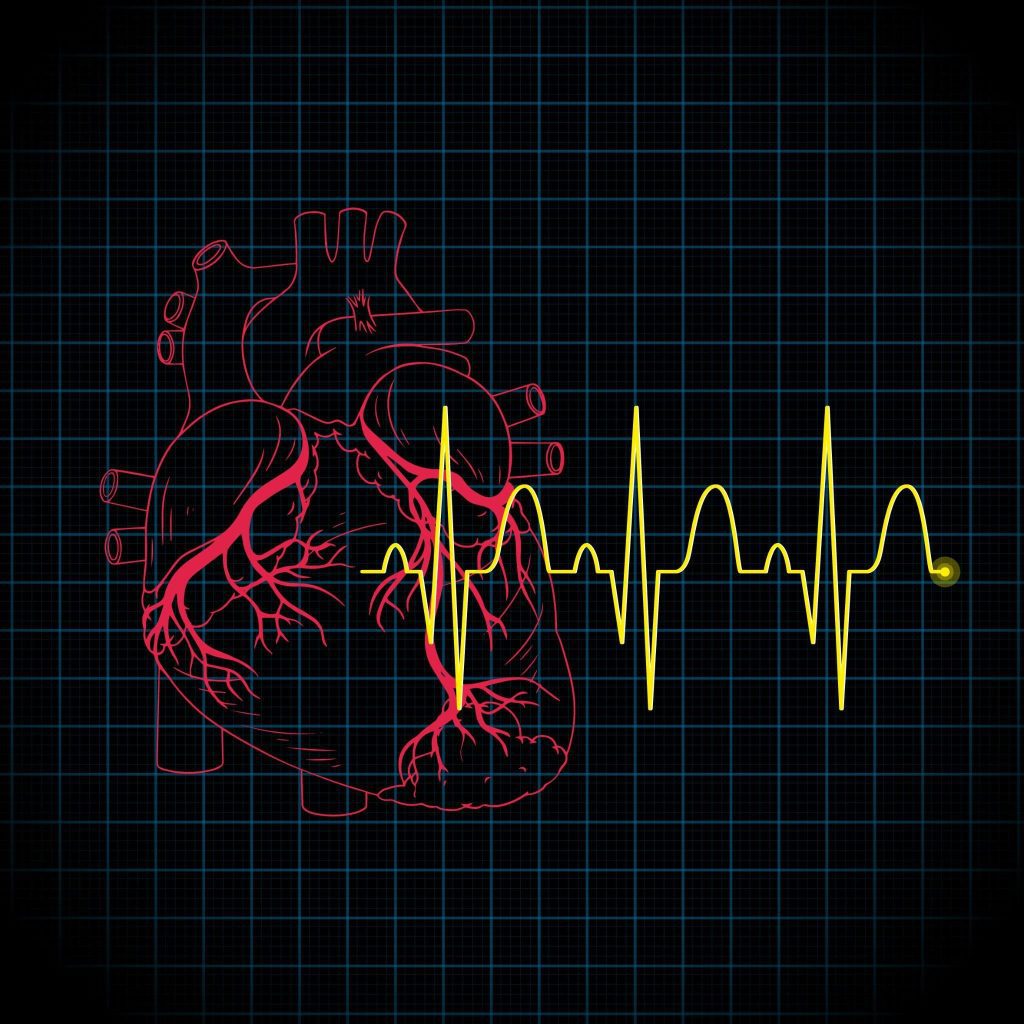 Heart Block: When your heart misses a beat