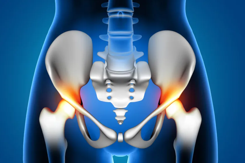 Orthopedic consultation and hip joint model used to explain total hip replacement procedure.