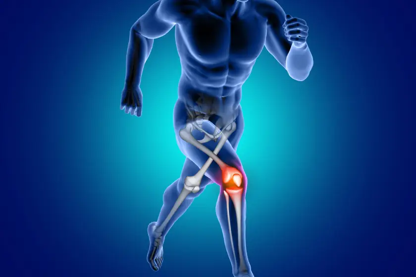 Knee Arthritis Early Signs and Expert Treatment at Aadicura